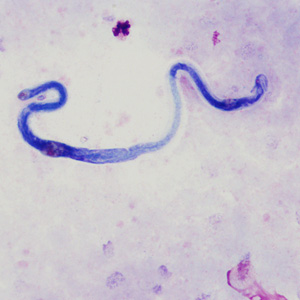 Case370_D.jpg Figure D