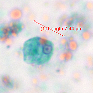 Case371_B.jpg Figure B