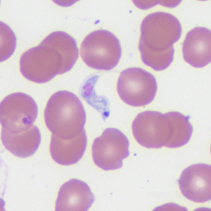 Case372_B.jpg Figure B