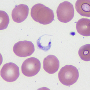 Case372_D.jpg Figure D