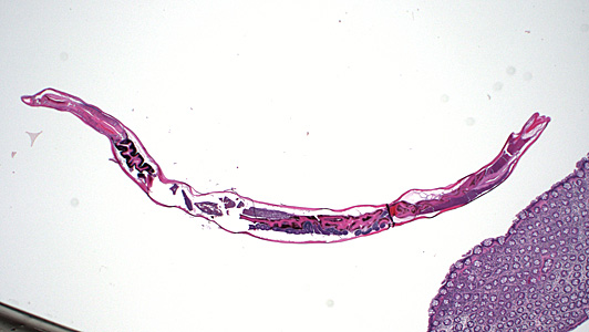 June - 2014 - Case #373 A worm-like object was observed during a routine colonoscopy screening of an adult living in Hawaii. The specimen was collected, sectioned, and stained with hematoxylin-and-eosin (H&E).