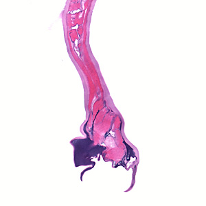 Case373_B.jpg Figure B