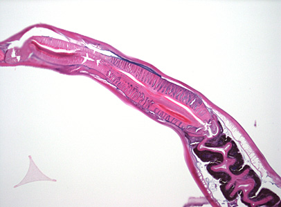 Case373_C.jpg Figure C