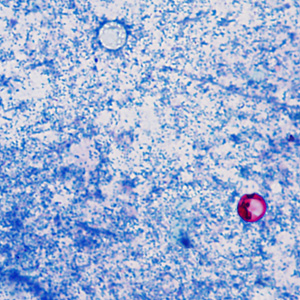 Case374_A.jpg Figure A