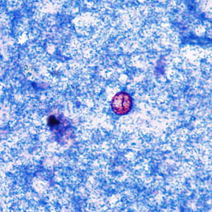 Case374_B.jpg Figure B