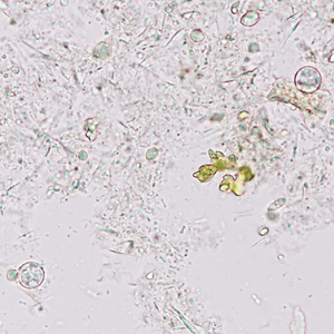 Case374_C.jpg Figure C