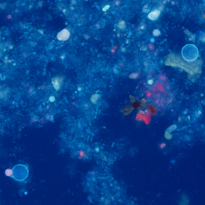 Case374_D.jpg Figure D