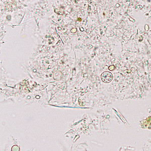 Case374_E.jpg Figure E