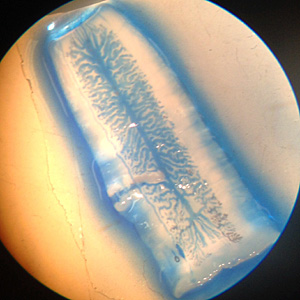 An 18-year-old female presented a worm-like object to her primary health care provider, claiming it was found in her stool. She spent two months in Mexico five years prior, and admitted seeing similar objects in her stool over the course of the five years.