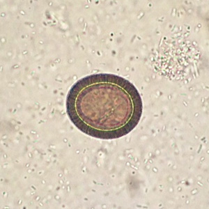 Case375_B.jpg Figure B