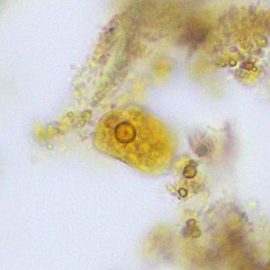 Case376_B.jpg Figure B