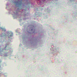 Case376_C.jpg Figure C