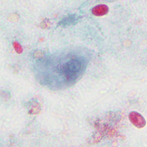 Case376_D.jpg Figure D