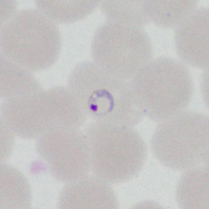 August - 2014 - Case #377 A 22-year-old man had a post-travel medical evaluation that included hematologic work-up after returning from an 11-day missionary trip to Honduras. Blood was collected in EDTA at a medical center and thin smears were prepared and stained for examination.