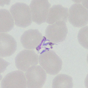 Case377_B.jpg Figure B