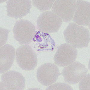 Case377_C.jpg Figure C