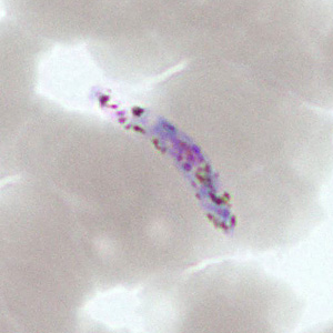 Case377_D.jpg Figure D