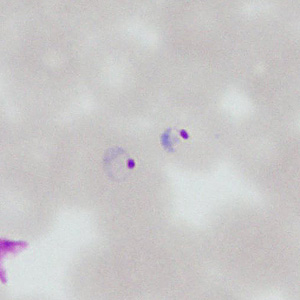 Case377_E.jpg Figure E