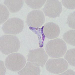 Case377_F.jpg Figure F