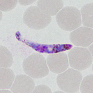 Case377_G.jpg Figure G