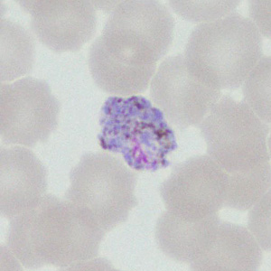 Case377_H.jpg Figure H