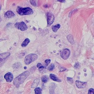 Case378_B.jpg Figure B