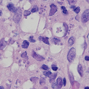 Case378_C.jpg Figure C