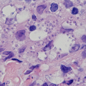 Case378_D.jpg Figure D