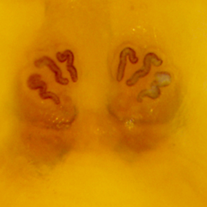 Case379_B.jpg Figure B