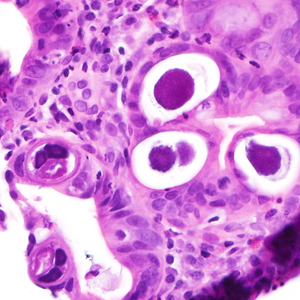 Case380_B.jpg Figure B