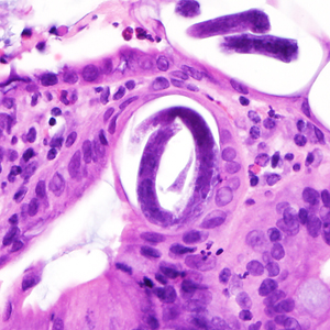 Case380_C.jpg Figure C