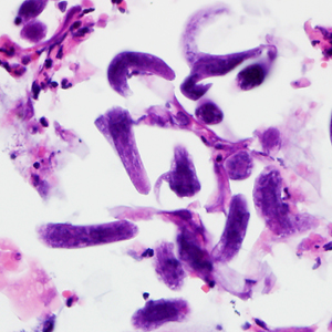 Case380_D.jpg Figure D