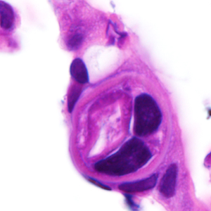 Case380_E.jpg Figure E