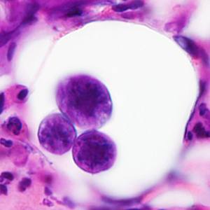 Case380_F.jpg Figure F