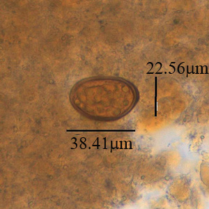 Case381_B.jpg Figure B