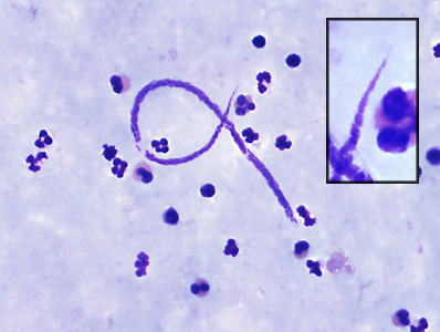 A 39-year-old immigrant from Panama sought medical evaluation for mild intermittent fevers.  A blood specimen was collected and thick and thin blood smears made and stained with Giemsa to confirm a presumed diagnosis of malaria. 