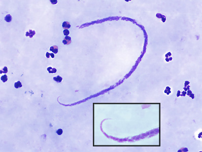 Case382_B.jpg Figure B