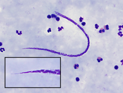 Case382_C.jpg Figure C