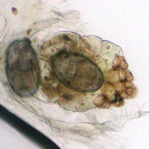 Case383_B.jpg Figure B