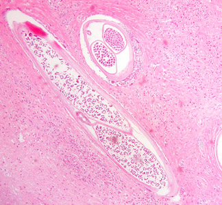 Case384_B.jpg Figure B