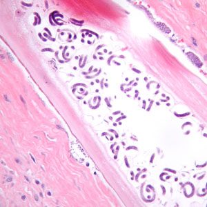 Case384_C.jpg Figure C