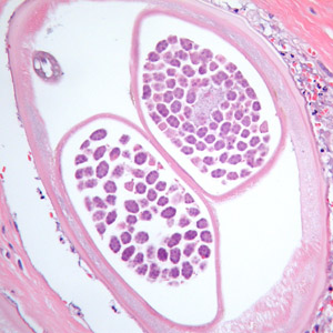 Case384_D.jpg Figure D