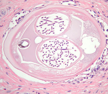 Case384_E.jpg Figure E
