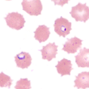 Case385_B.jpg Figure B