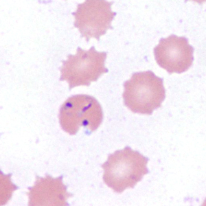 Case385_C.jpg Figure C