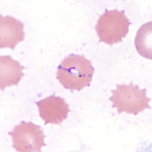 Case385_D.jpg Figure D