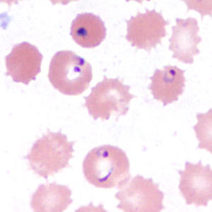 Case385_E.jpg Figure E