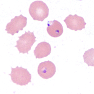 Case385_F.jpg Figure F