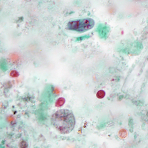 Case386_B.jpg Figure B