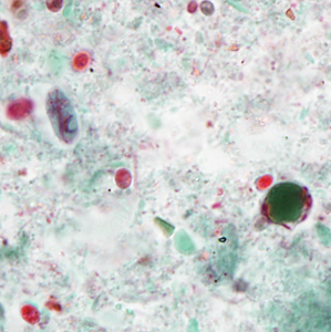 Case386_C.jpg Figure C